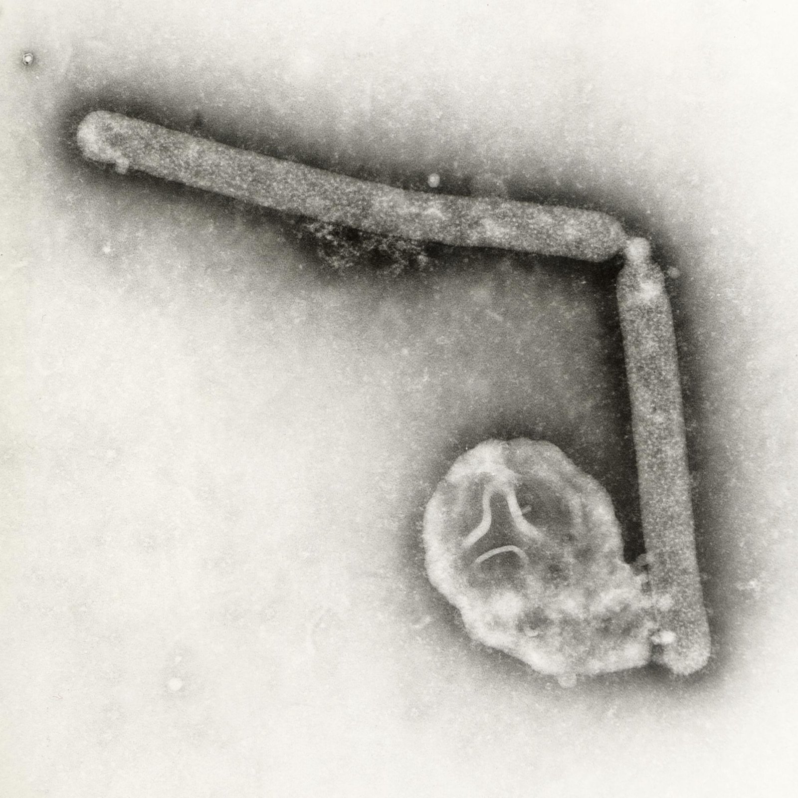 Detectan mutación del virus aviar en paciente de Luisiana; descartan contagio entre personas